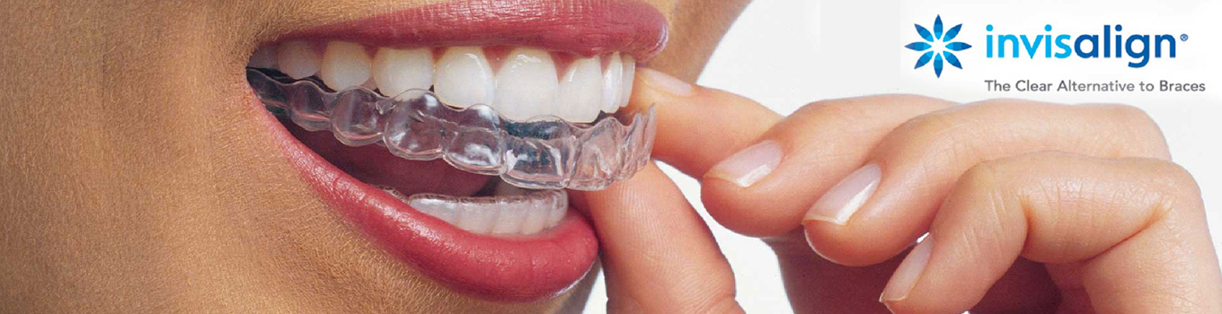 Contemporary Orthodontics